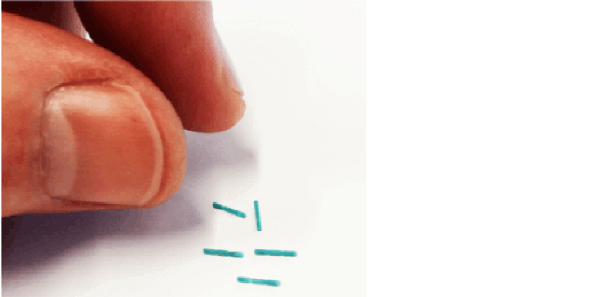 VasDeBlock devices inserted to vasa deferentia vas